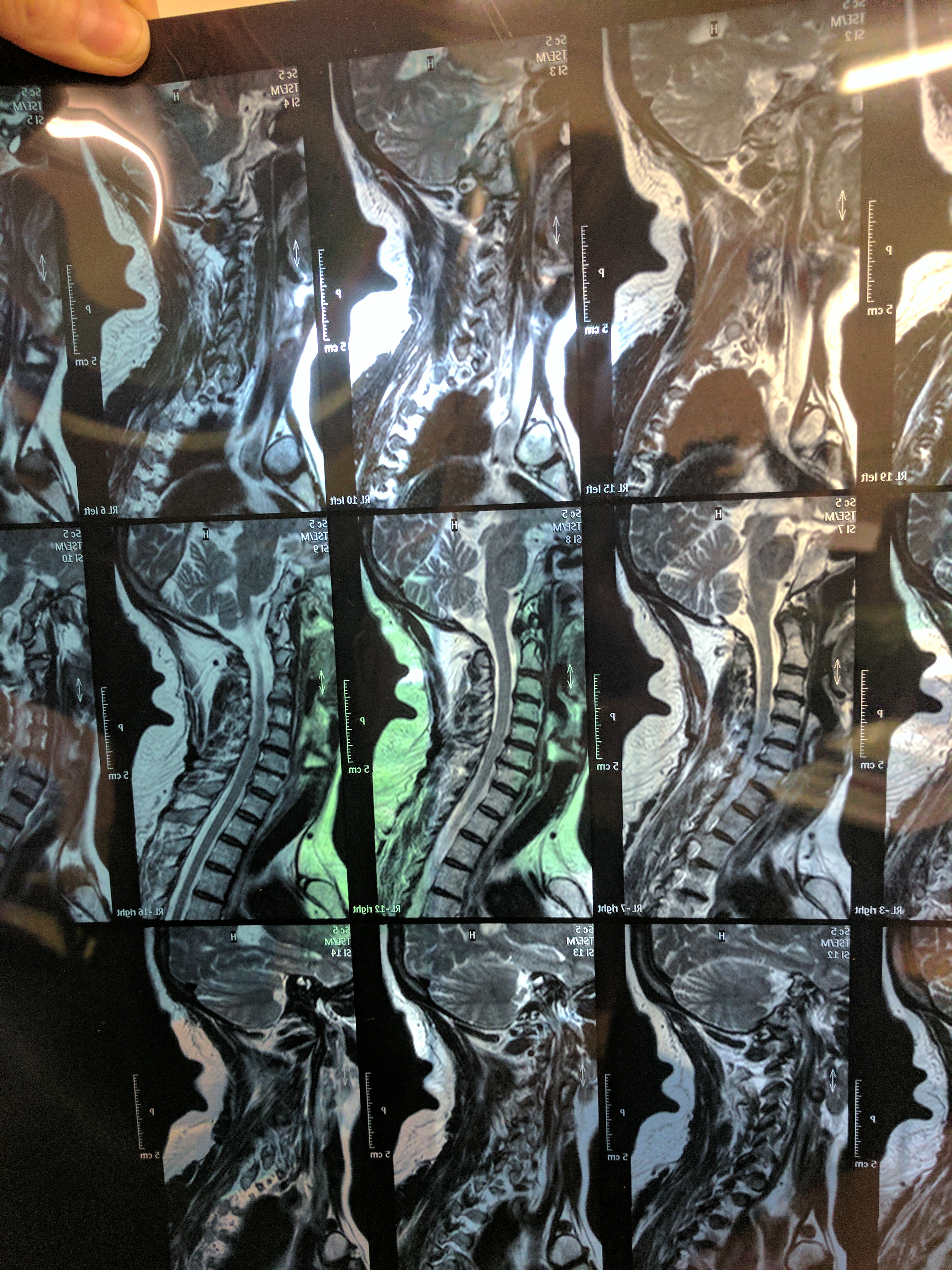 X-ray film scanning service